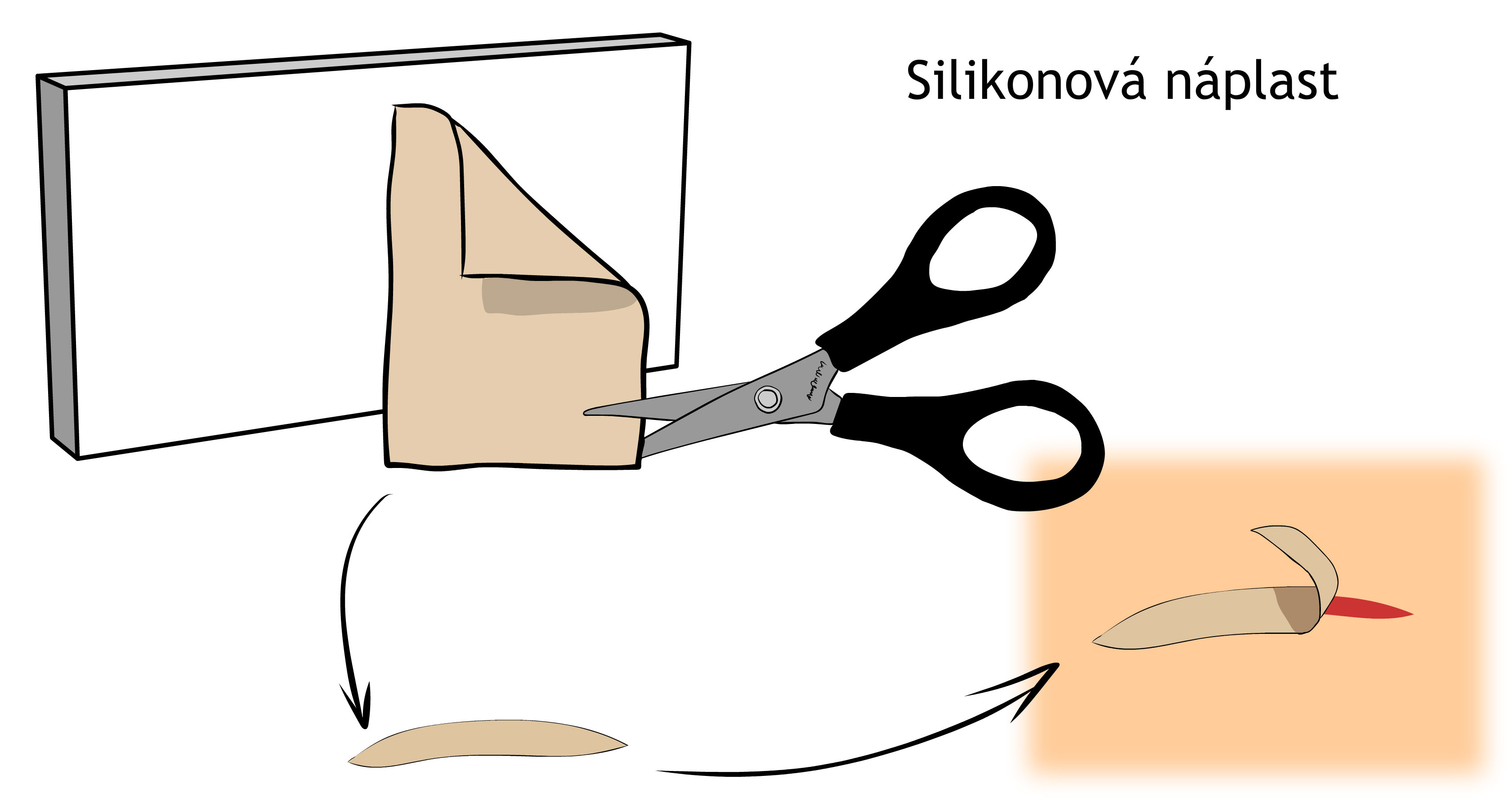 Silikonová náplast